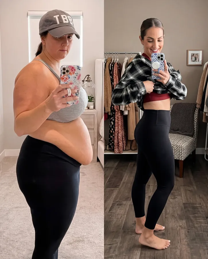 Before and After HerMethod - Jasmine K.