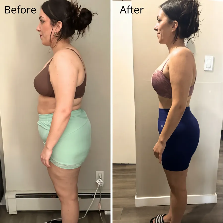 Before and After HerMethod - Diana F.