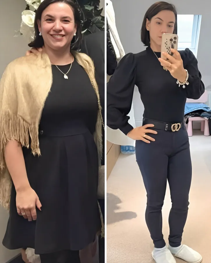 Before and After HerMethod - Zara T.